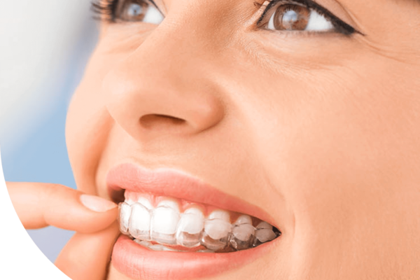 Invisalign Aberdeen