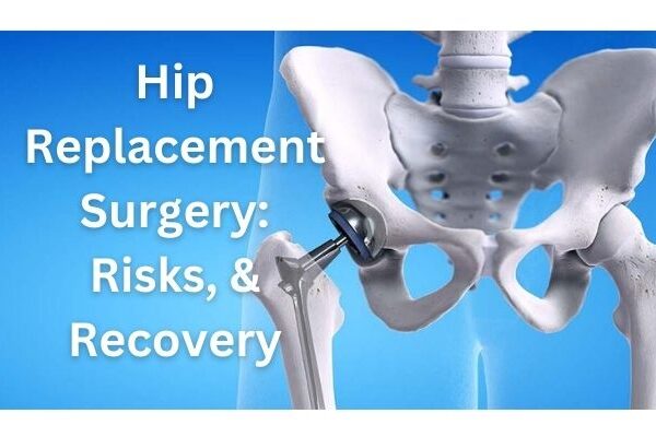 hip replacement