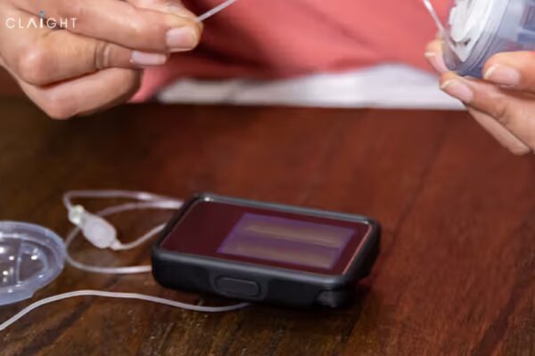 India Insulin Pumps Market