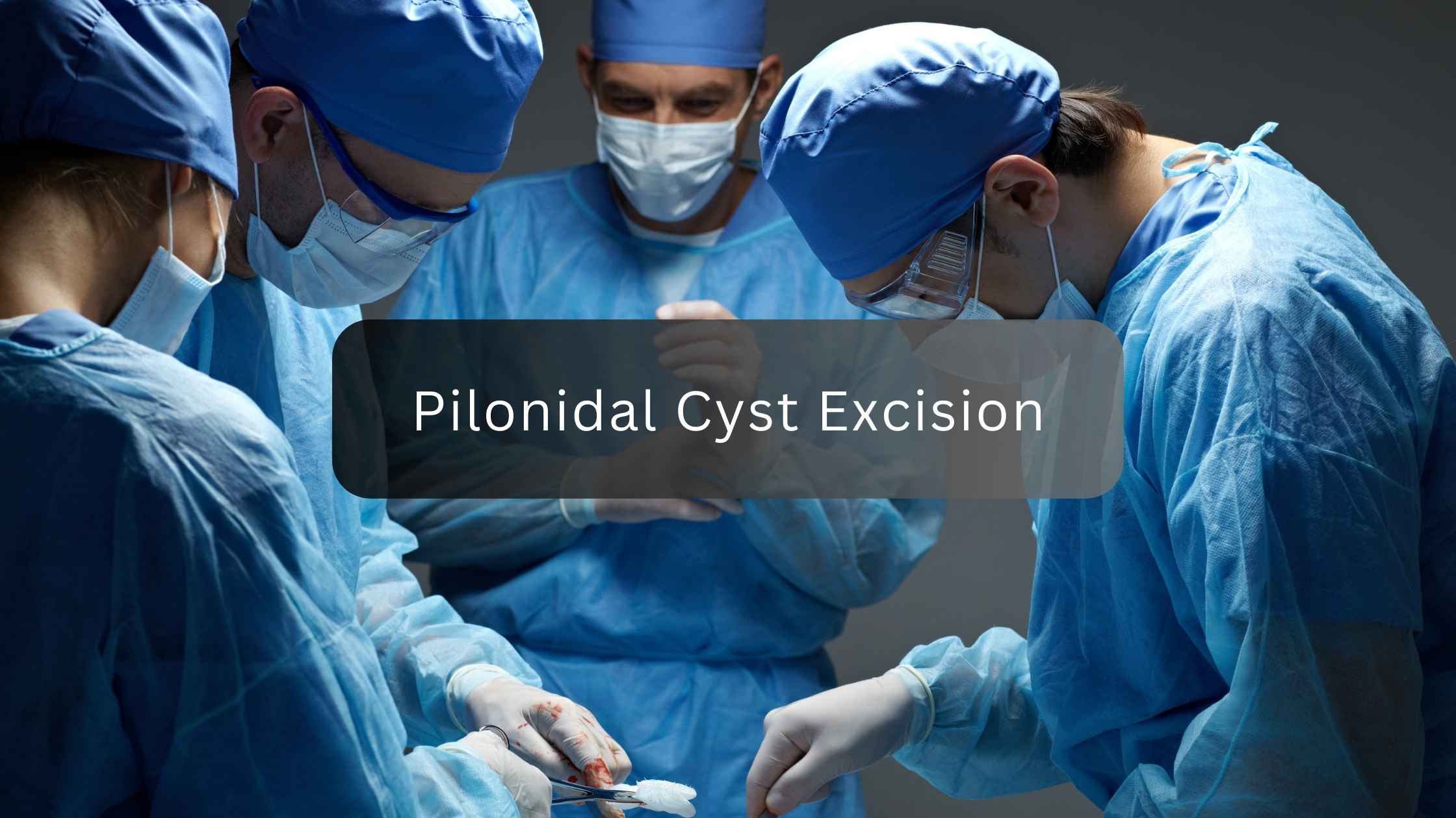 pilonidal cyst excision