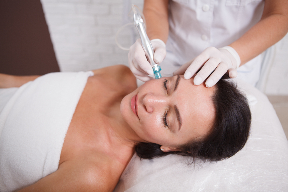 Microneedling Explained: Is It Right for Your Skin Type?